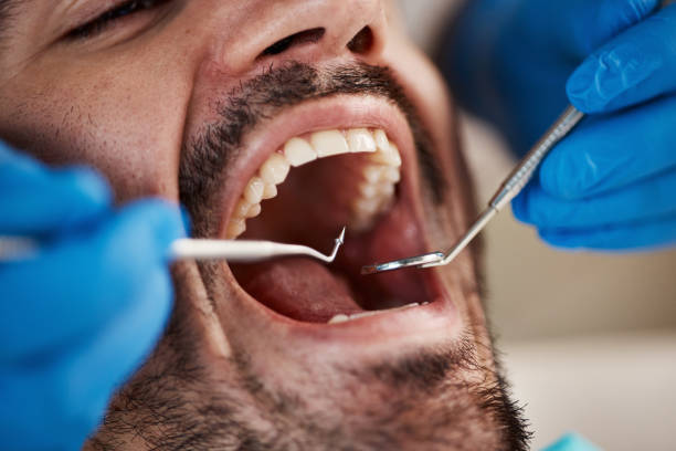Best Emergency Dental Filling Replacement  in Mexico Beach, FL